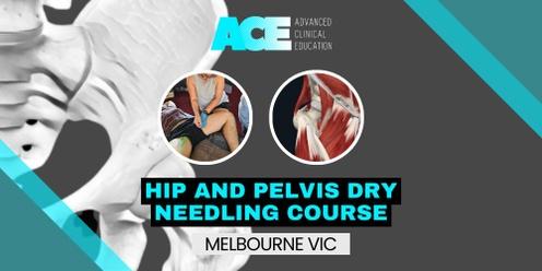 Hip and Pelvis Dry Needling Course (Melbourne VIC)